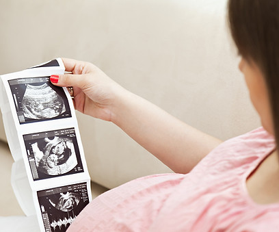 Pregnant woman holding ultrasound