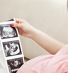 Mulher grávida segurando ultrassom