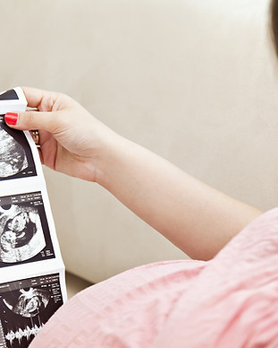 Ultrasound