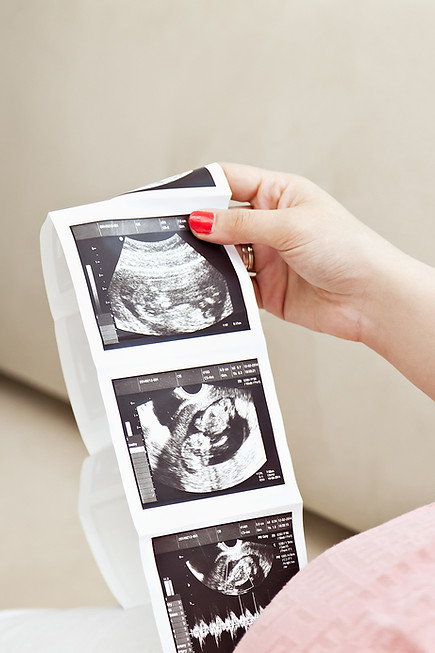 Pregnant woman holding ultrasound