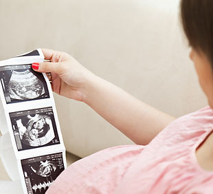 Ultrasound