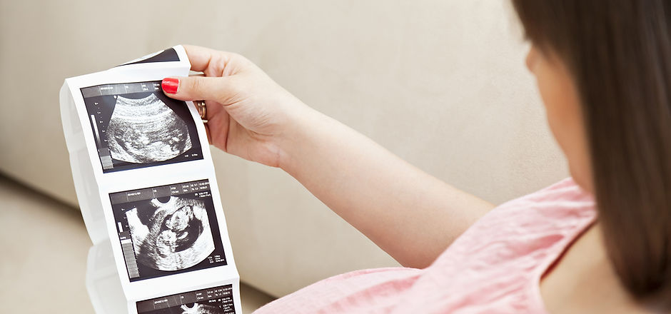 Ultrasound
