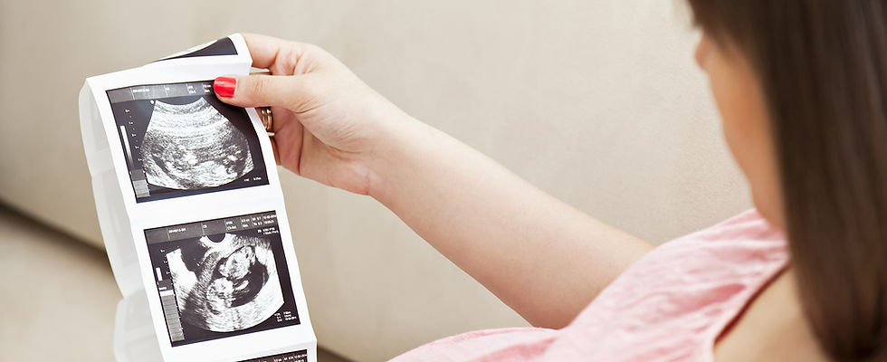 Ultrasound