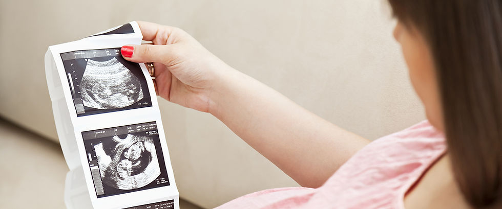 Ultrasound