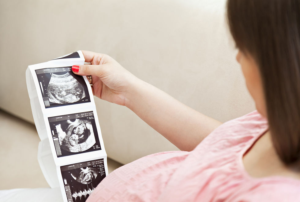 Ultrasound