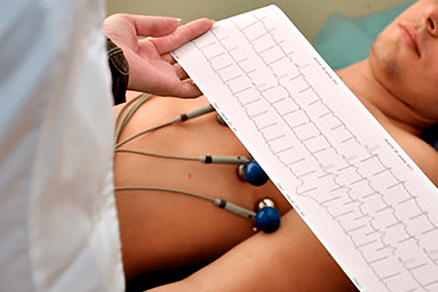 debo-realizarme-ekg.png