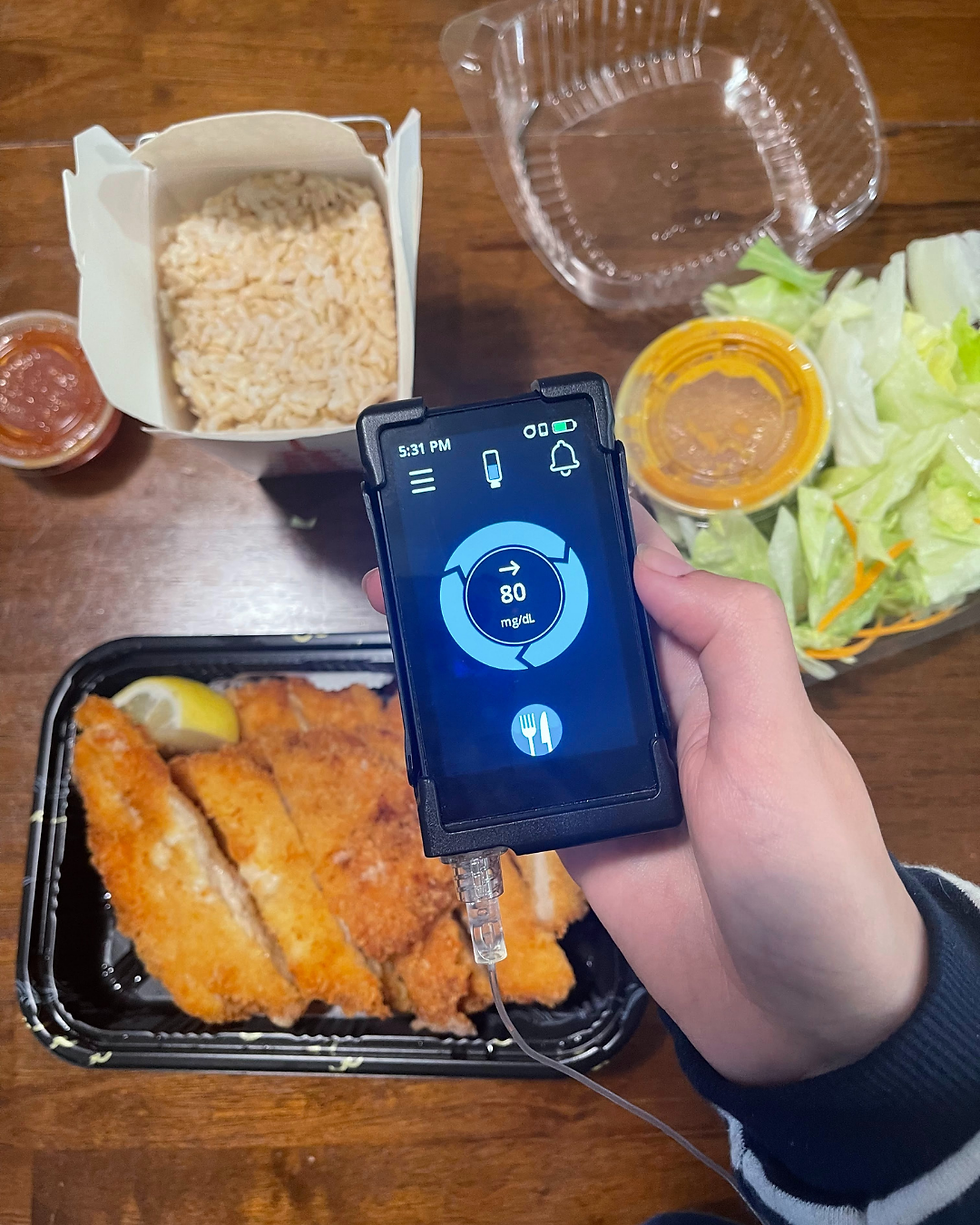 Image of ilet bionic pancreas with a meal