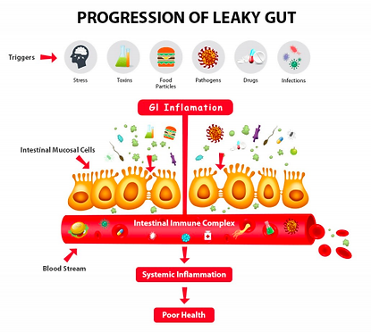 Leaky Gut Picture.jpg