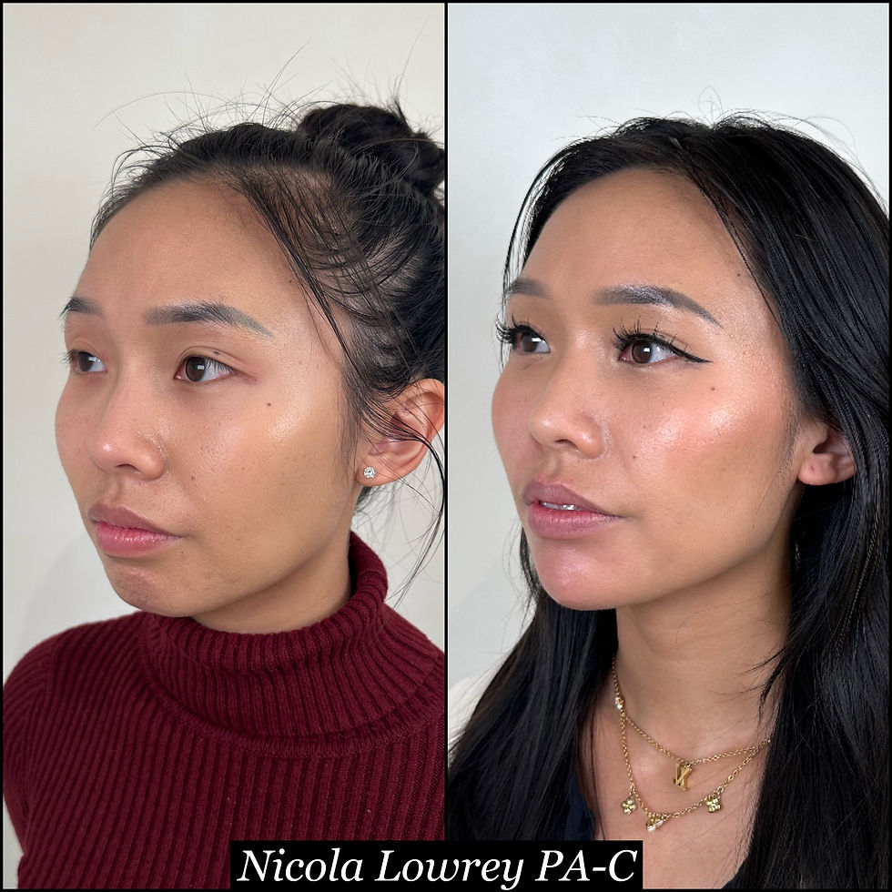 #FridayFeels: A Master Class in Facial Balancing Nov 21, 2025