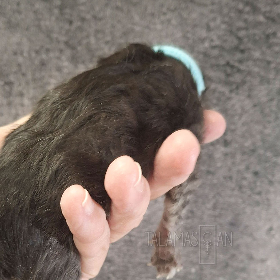 Light Blue Collar - Newborn - B26