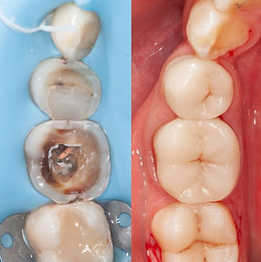 Dr. Omar Rakeen - implantologist dentist - Confdent Palm Dentist Dubai Palm Jumeirah .jpg