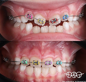 Dr. Akram Altawachi - Specialist Orthodontist in Dubai I ConfiDent ® Palm Dentist.jpg