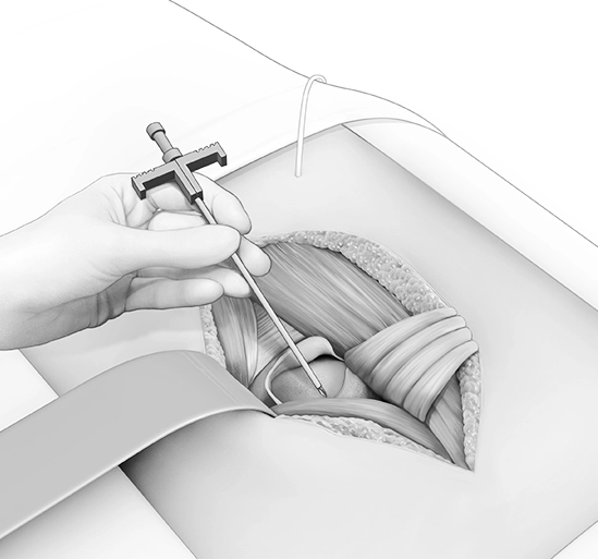 black_white_medical_illustration.webp