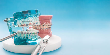 Les urgences en orthodontie