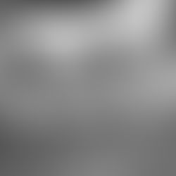 사평역치과 오늘의 재신경치료 재근관치료