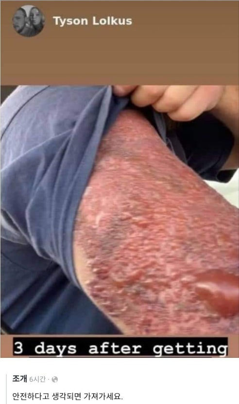 ree