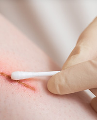 medical-assistant-changes-dressing-wound