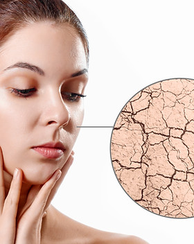 zoom-circle-shows-dry-facial-skin-before