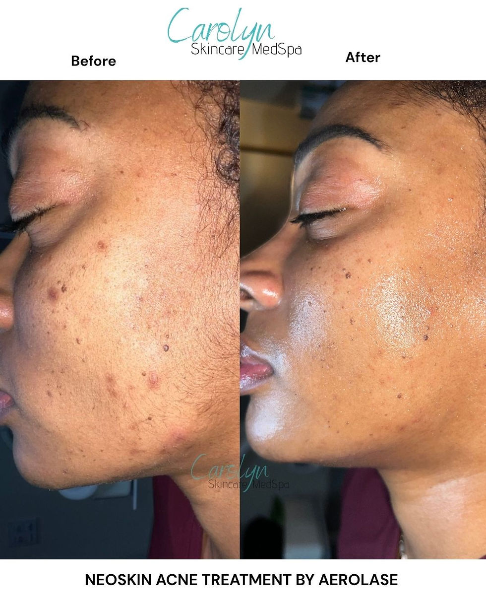 BEFORE & AFTER FINAL (6).jpg