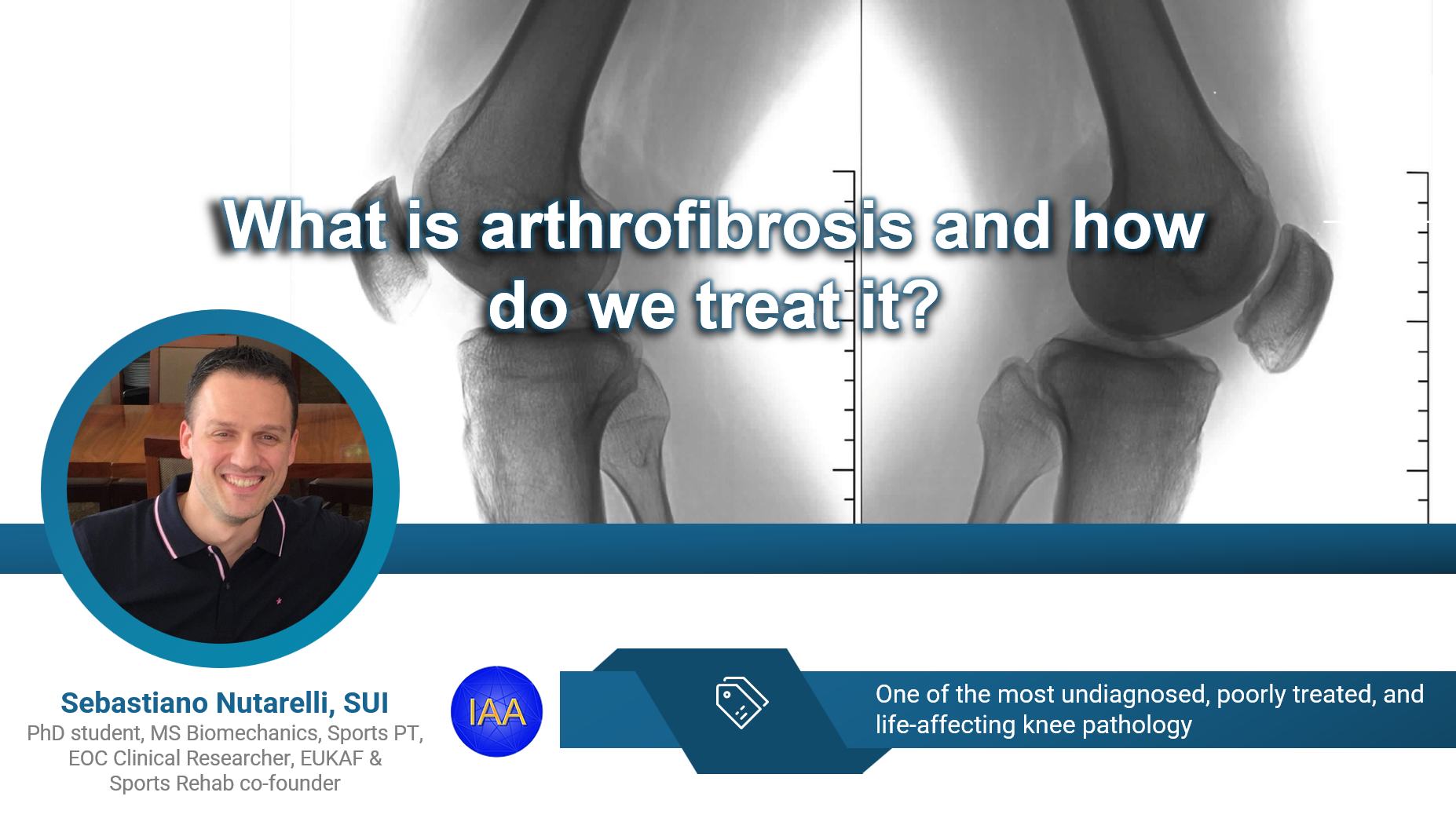 Presentation slide: What is arthrofibrosis and how do we treat it? (knee illustration)