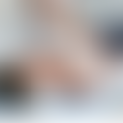 Fisioterapia no Pré e Pós-Operatório de Cirurgias Estéticas