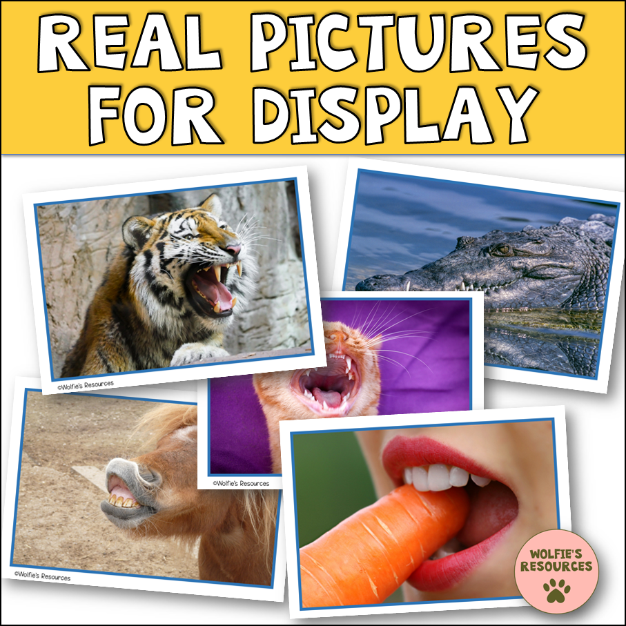 Thumbnail: Teeth Year 4