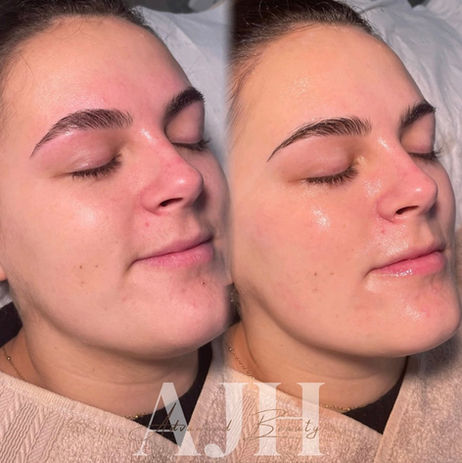 AJH Advanced beauty before and after facial services