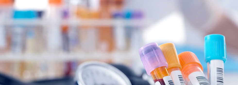Medical test tubes close-up
