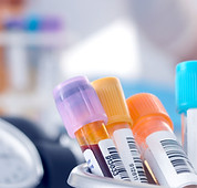 Blood Samples