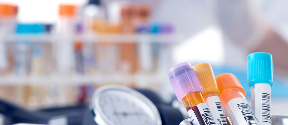Blood Samples