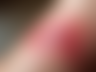 Understanding the Stages of Skin Healing during Topical Steroid Withdrawal