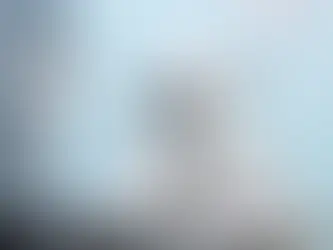 تجربتي مع الليزر السطحي