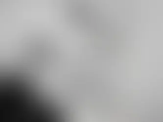 العمر المناسب لعملية تصحيح النظر