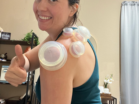 Client receiving cupping therapy on upper back to relieve muscle tension and improve circulation at a massage studio in Round Rock, TX.