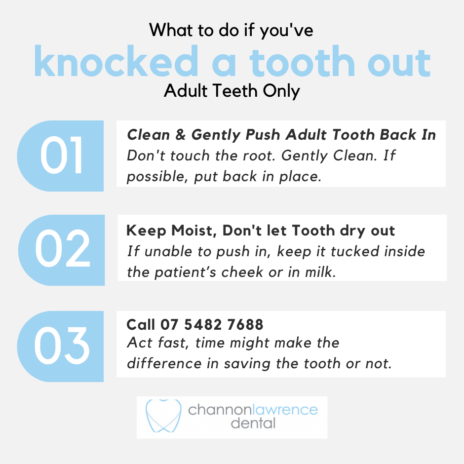 What to Do if You've knocked a tooth out, Channon Lawrence Dental Gympie, Gympie Dentist, Emergency Dentist, Dental Emergency