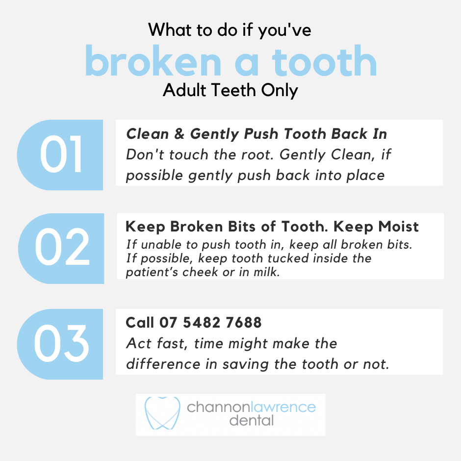 Three tips for when you've broken a tooth, Channon Lawrence Dental, Gympie Dentist, Broken Tooth, Knocked Tooth, Snapped Tooth