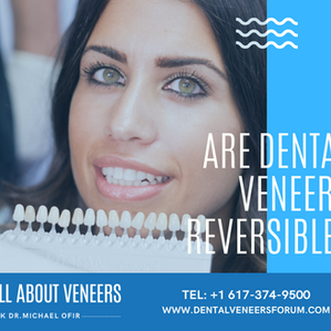 Are dental veneers reversible?