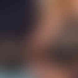 full-mouth reconstruction