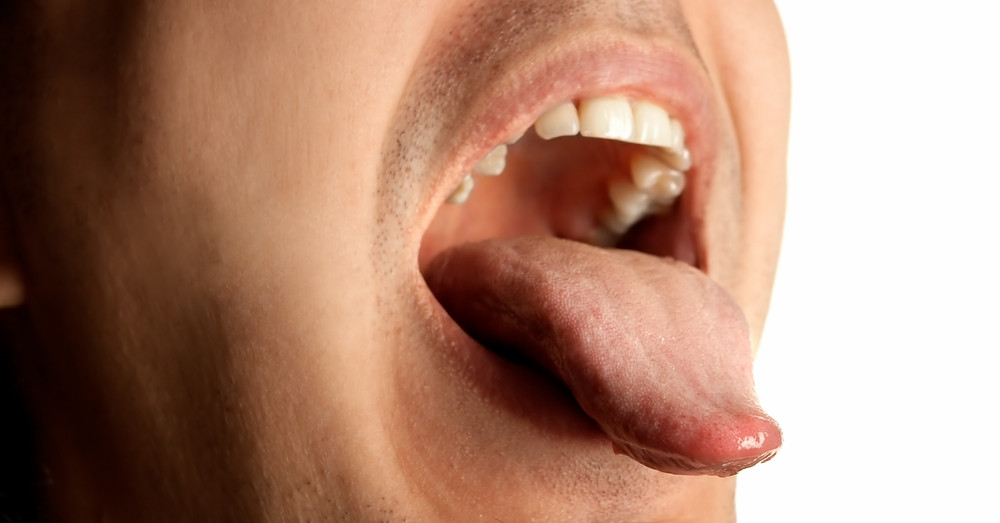 man's mouth oral cancer screening