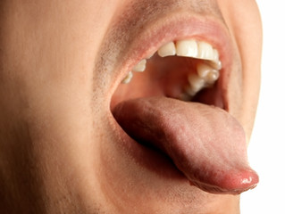 How is Oral Cancer Detected?