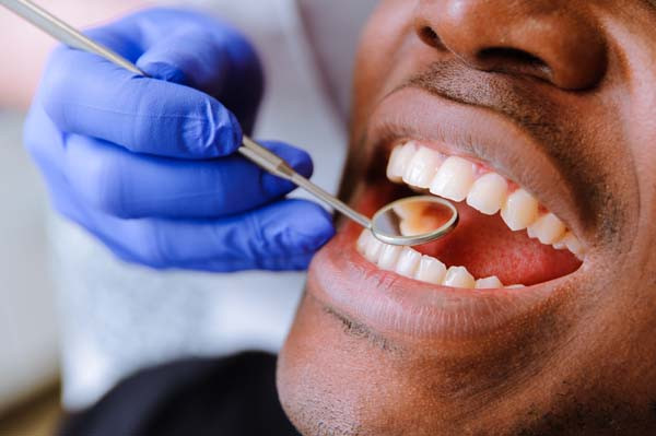 dental check up of black man gum disease