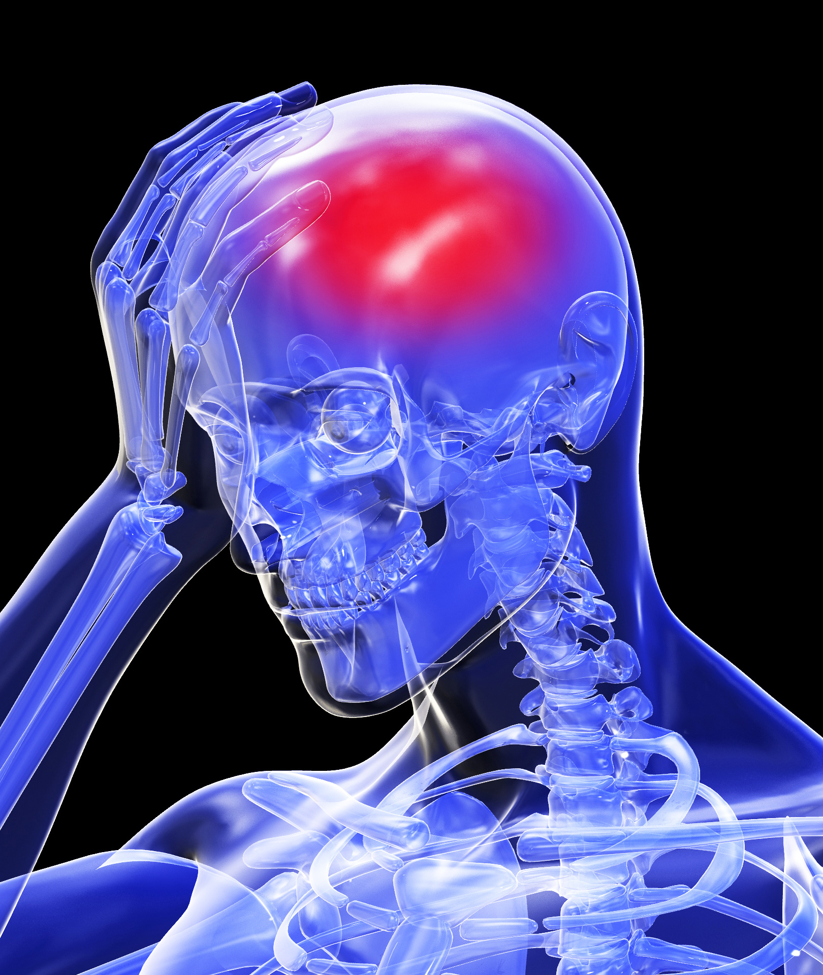 Types of Headaches content media