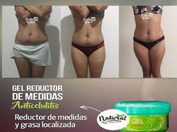 Testimonio Gel Reductor de Medidas