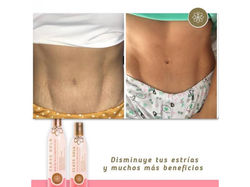 Testimonio Aceite Multibeneficios