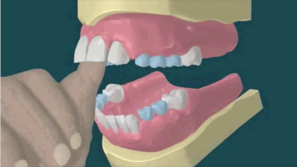 ezgif.com-gif-maker (1).gif