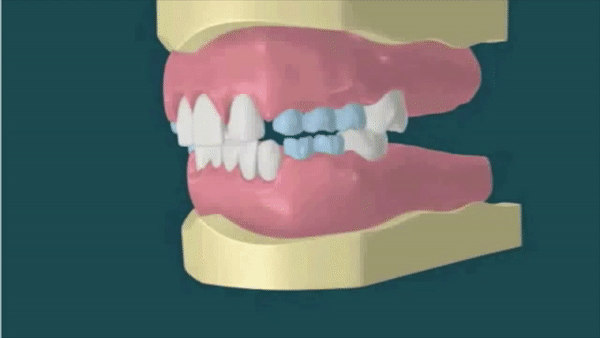 ezgif.com-gif-maker.gif