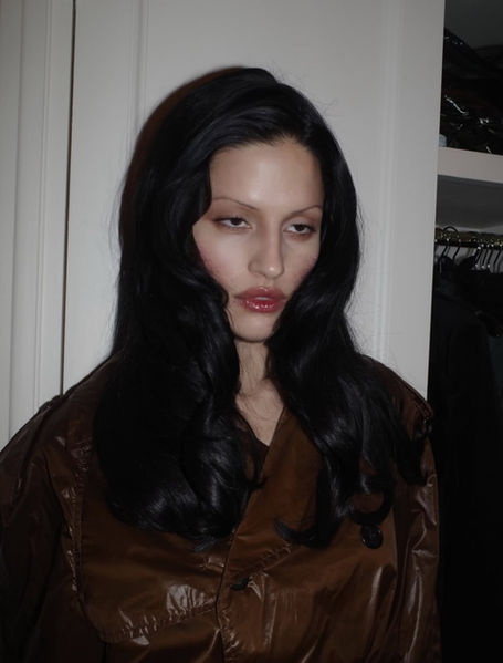 You Don’t Have to Get Plastic Surgery, But Good Luck Competing If You Don’t