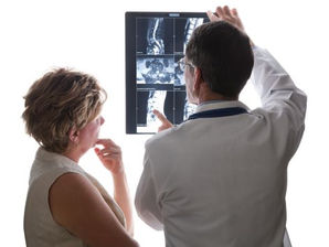 EsSalud: 80% de mujeres mayores de 50 años padece de osteoporosis y no lo sabe