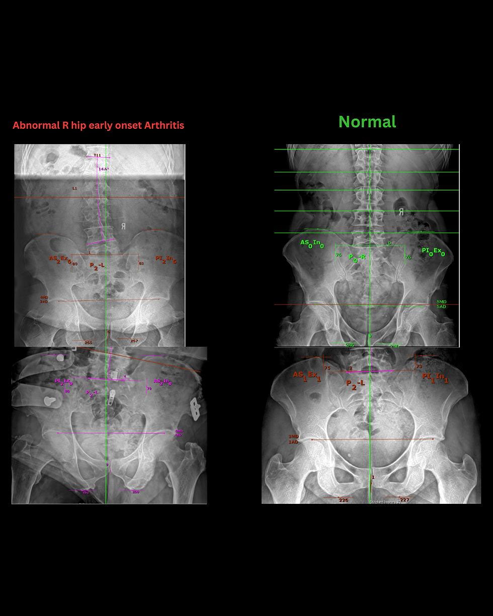 Hip Pain - Photo.png