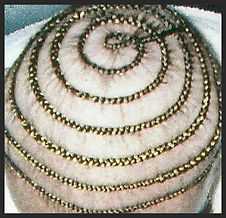 Hair Extensions, Hair weaving for Hair Loss